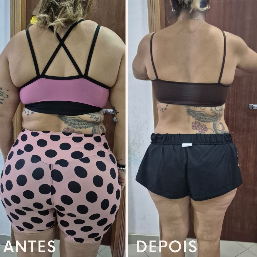 Resultado 4