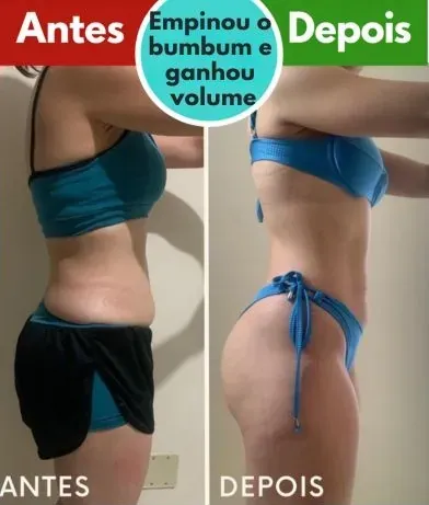 Antes e depois: empinou o bumbum e ganhou volume